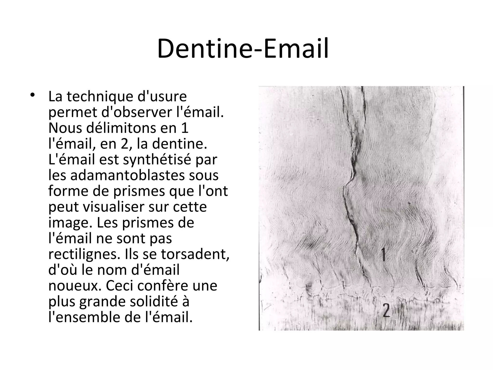 Dentine-Email
• La technique d'usure
permet d'observer l'émail.
Nous délimitons en 1
l'émail, en 2, la dentine.
L'émail est synthétisé par
les adamantoblastes sous
forme de prismes que l'ont
peut visualiser sur cette
image. Les prismes de
l'émail ne sont pas
rectilignes. Ils se torsadent,
d'où le nom d'émail
noueux. Ceci confère une
plus grande solidité à
l'ensemble de l'émail.
 