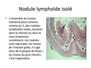 Nodule lymphoïde isolé
• L'ensemble du tractus 
intestinal peut contenir, 
comme en 1, des nodules 
lymphoïdes isolés, localisés 
dans le chorion ou dans la 
sous-muqueuse. 
Localement, ces nodules 
sont regroupés. Au niveau 
de l'intestin grêle, il s'agit 
alors de la plaque de Peyer ; 
au niveau du gros intestin, 
c'est l'appendice. 
 