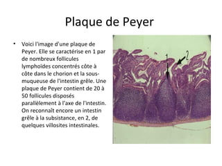 Plaque de Peyer 
• Voici l'image d'une plaque de 
Peyer. Elle se caractérise en 1 par 
de nombreux follicules 
lymphoïdes concentrés côte à 
côte dans le chorion et la sous-
muqueuse de l'intestin grêle. Une 
plaque de Peyer contient de 20 à 
50 follicules disposés 
parallèlement à l'axe de l'intestin. 
On reconnaît encore un intestin 
grêle à la subsistance, en 2, de 
quelques villosites intestinales. 
 
