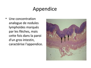 Appendice 
• Une concentration 
analogue de nodules 
lymphoïdes marqués 
par les flèches, mais 
cette fois dans la paroi 
d'un gros intestin, 
caractérise l'appendice. 
 