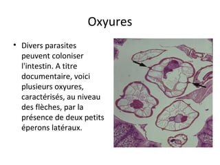 Oxyures
• Divers parasites 
peuvent coloniser 
l'intestin. A titre 
documentaire, voici 
plusieurs oxyures, 
caractérisés, au niveau 
des flèches, par la 
présence de deux petits 
éperons latéraux.  
 