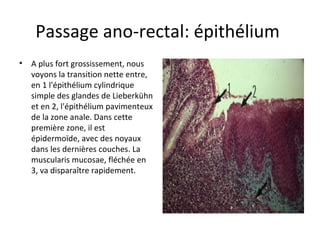 Passage ano-rectal: épithélium 
• A plus fort grossissement, nous 
voyons la transition nette entre, 
en 1 l'épithélium cylindrique 
simple des glandes de Lieberkühn 
et en 2, l'épithélium pavimenteux 
de la zone anale. Dans cette 
première zone, il est 
épidermoïde, avec des noyaux 
dans les dernières couches. La 
muscularis mucosae, fléchée en 
3, va disparaître rapidement. 
 