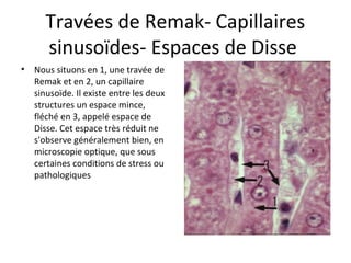 Travées de Remak- Capillaires 
sinusoïdes- Espaces de Disse 
• Nous situons en 1, une travée de 
Remak et en 2, un capillaire 
sinusoïde. Il existe entre les deux 
structures un espace mince, 
fléché en 3, appelé espace de 
Disse. Cet espace très réduit ne 
s'observe généralement bien, en 
microscopie optique, que sous 
certaines conditions de stress ou 
pathologiques 
 