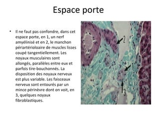 Espace porte 
• Il ne faut pas confondre, dans cet 
espace porte, en 1, un nerf 
amyélinisé et en 2, le manchon 
périartérioloaire de muscles lisses 
coupé tangentiellement. Les 
noyaux musculaires sont 
allongés, parallèles entre eux et 
parfois tire-bouchonnés. La 
disposition des noyaux nerveux 
est plus variable. Les faisceaux 
nerveux sont entourés par un 
mince périnèvre dont on voit, en 
3, quelques noyaux 
fibroblastiques.  
 