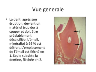 Vue generale
• La dent, après son
éruption, devient un
matériel trop dur à
couper et doit être
préalablement
décalcifiée. L'émail,
minéralisé à 96 % est
détruit. L'emplacement
de l'émail est fléché en
1. Seule subsiste la
dentine, fléchée en 2.
 