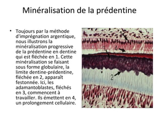 Minéralisation de la prédentine
• Toujours par la méthode
d'imprégnation argentique,
nous illustrons la
minéralisation progressive
de la prédentine en dentine
qui est fléchée en 1. Cette
minéralisation se faisant
sous forme globulaire, la
limite dentine-prédentine,
fléchée en 2, apparaît
festonnée. Ici, les
adamantoblastes, fléchés
en 3, commencent à
travailler. Ils émettent en 4,
un prolongement cellulaire.
 