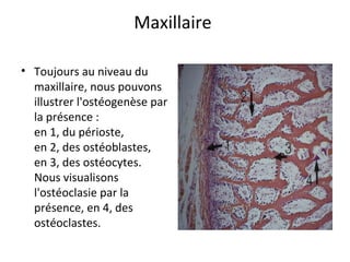 Maxillaire
• Toujours au niveau du
maxillaire, nous pouvons
illustrer l'ostéogenèse par
la présence :
en 1, du périoste,
en 2, des ostéoblastes,
en 3, des ostéocytes.
Nous visualisons
l'ostéoclasie par la
présence, en 4, des
ostéoclastes.
 