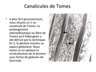 Canalicules de Tomes
• A plus fort grossissement,
nous situons en 1 un
canalicule de Tomes. Le
prolongement
odontoblastique ou fibre de
Tomes qu'il hébergeait a
été détruit par la technique.
En 2, la dentine montre un
aspect globulaire. Nous
avons vu en optique la
minéralisation de la dentine
sous forme de globules de
Gzermak.
 