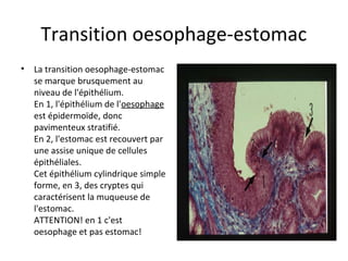 Transition oesophage-estomac
• La transition oesophage-estomac 
se marque brusquement au 
niveau de l'épithélium.
En 1, l'épithélium de l'oesophage 
est épidermoïde, donc 
pavimenteux stratifié. 
En 2, l'estomac est recouvert par 
une assise unique de cellules 
épithéliales. 
Cet épithélium cylindrique simple 
forme, en 3, des cryptes qui 
caractérisent la muqueuse de 
l'estomac. 
ATTENTION! en 1 c'est 
oesophage et pas estomac! 
 