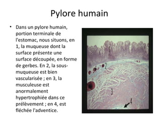 Pylore humain 
• Dans un pylore humain, 
portion terminale de 
l'estomac, nous situons, en 
1, la muqueuse dont la 
surface présente une 
surface découpée, en forme 
de gerbes. En 2, la sous-
muqueuse est bien 
vascularisée ; en 3, la 
musculeuse est 
anormalement 
hypertrophiée dans ce 
prélèvement ; en 4, est 
fléchée l'adventice.  
 