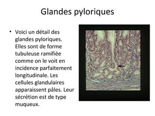 Glandes pyloriques
• Voici un détail des 
glandes pyloriques. 
Elles sont de forme 
tubuleuse ramifiée 
comme on le voit en 
incidence parfaitement 
longitudinale. Les 
cellules glandulaires 
apparaissent pâles. Leur 
sécrétion est de type 
muqueux.  
 