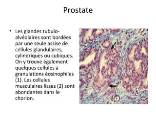 Prostate
• Les glandes tubulo-
alvéolaires sont bordées 
par une seule assise de 
cellules glandulaires, 
cylindriques ou cubiques. 
On y trouve également 
quelques cellules à 
granulations éosinophiles 
(1). Les cellules 
musculaires lisses (2) sont 
abondantes dans le 
chorion.  
 