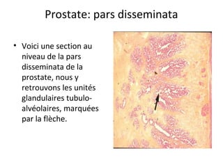 Prostate: pars disseminata
• Voici une section au 
niveau de la pars 
disseminata de la 
prostate, nous y 
retrouvons les unités 
glandulaires tubulo-
alvéolaires, marquées 
par la flèche.
 