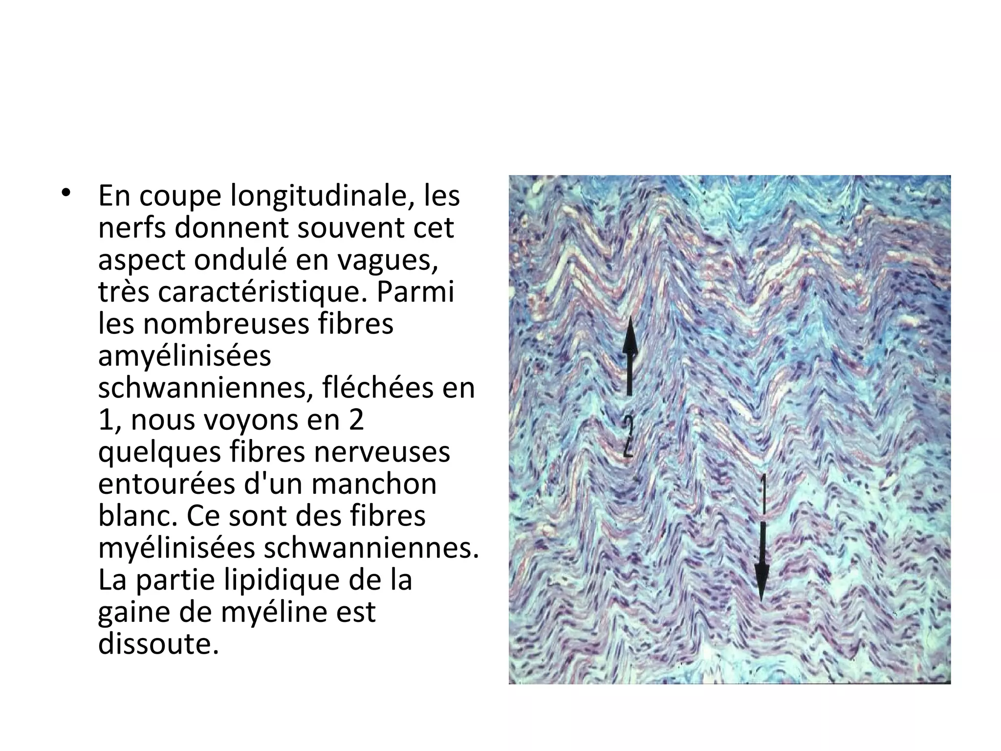 • En coupe longitudinale, les 
nerfs donnent souvent cet 
aspect ondulé en vagues, 
très caractéristique. Parmi 
les nombreuses fibres 
amyélinisées 
schwanniennes, fléchées en 
1, nous voyons en 2 
quelques fibres nerveuses 
entourées d'un manchon 
blanc. Ce sont des fibres 
myélinisées schwanniennes. 
La partie lipidique de la 
gaine de myéline est 
dissoute.
 