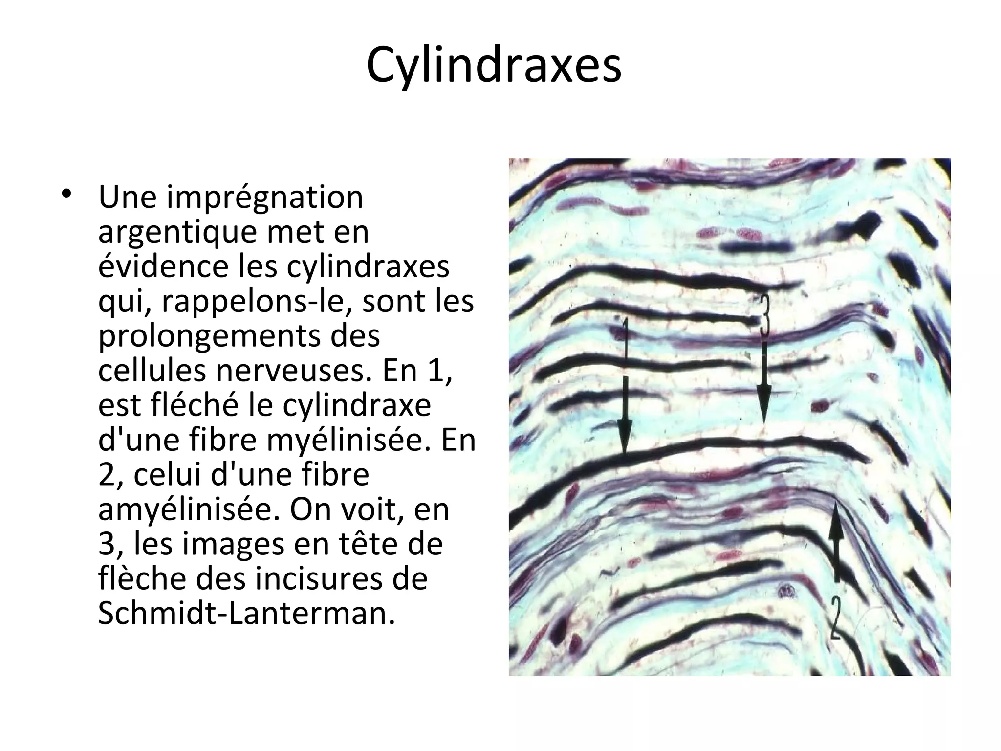 Cylindraxes 
• Une imprégnation 
argentique met en 
évidence les cylindraxes 
qui, rappelons-le, sont les 
prolongements des 
cellules nerveuses. En 1, 
est fléché le cylindraxe 
d'une fibre myélinisée. En 
2, celui d'une fibre 
amyélinisée. On voit, en 
3, les images en tête de 
flèche des incisures de 
Schmidt-Lanterman. 
 