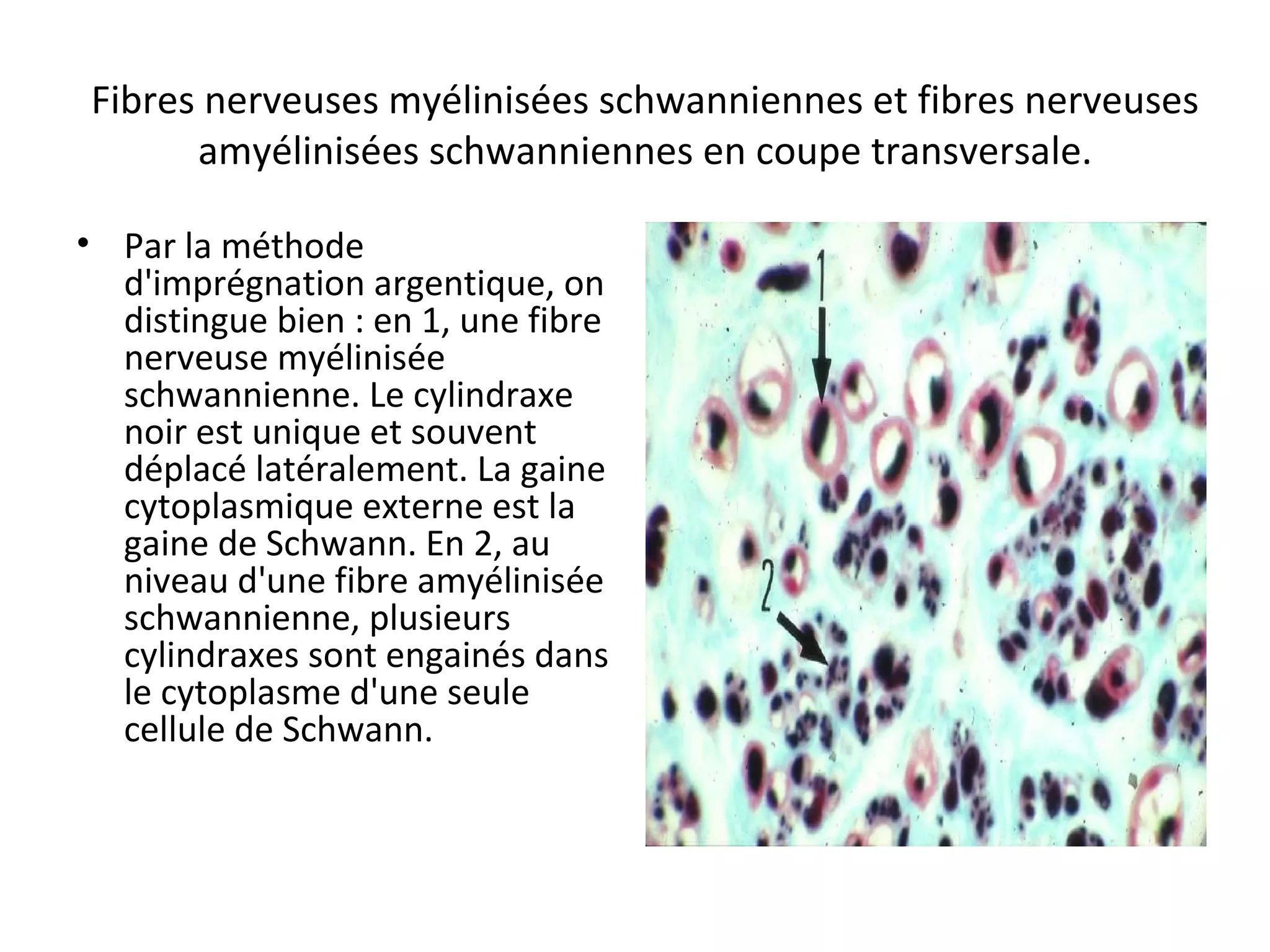Fibres nerveuses myélinisées schwanniennes et fibres nerveuses
amyélinisées schwanniennes en coupe transversale.
• Par la méthode
d'imprégnation argentique, on
distingue bien : en 1, une fibre
nerveuse myélinisée
schwannienne. Le cylindraxe
noir est unique et souvent
déplacé latéralement. La gaine
cytoplasmique externe est la
gaine de Schwann. En 2, au
niveau d'une fibre amyélinisée
schwannienne, plusieurs
cylindraxes sont engainés dans
le cytoplasme d'une seule
cellule de Schwann.
 