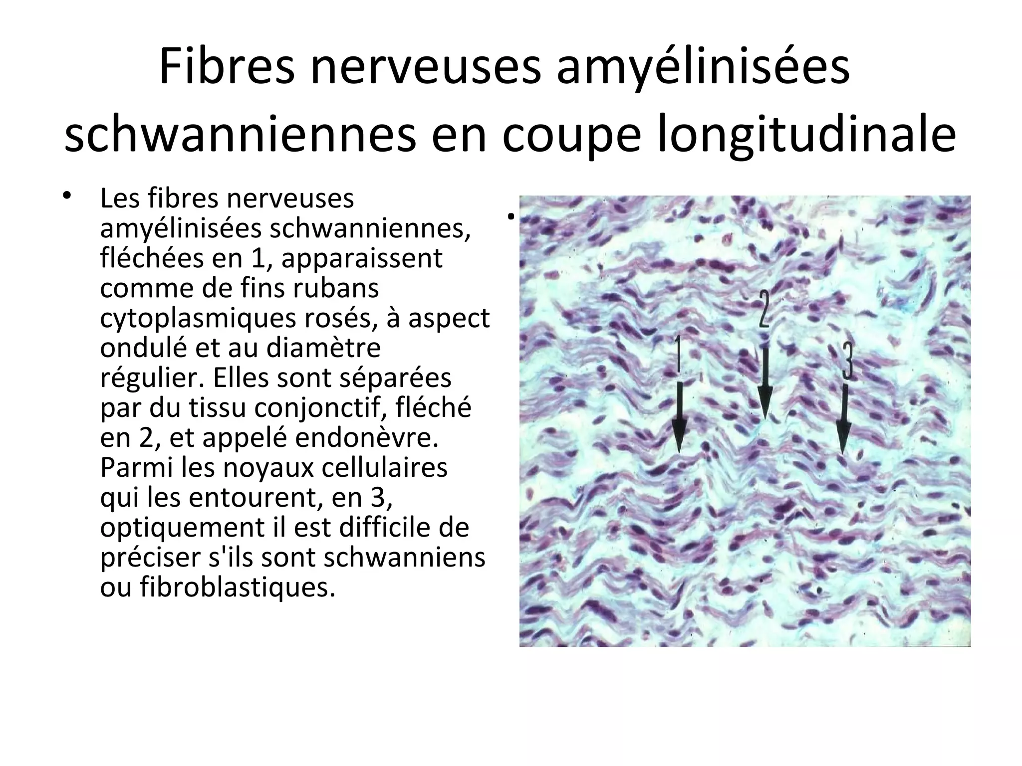 Fibres nerveuses amyélinisées 
schwanniennes en coupe longitudinale
.• Les fibres nerveuses 
amyélinisées schwanniennes, 
fléchées en 1, apparaissent 
comme de fins rubans 
cytoplasmiques rosés, à aspect 
ondulé et au diamètre 
régulier. Elles sont séparées 
par du tissu conjonctif, fléché 
en 2, et appelé endonèvre. 
Parmi les noyaux cellulaires 
qui les entourent, en 3, 
optiquement il est difficile de 
préciser s'ils sont schwanniens 
ou fibroblastiques. 
 