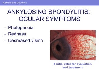 Ocular Manifestations of Systemic Disease | PDF
