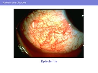 Ocular Manifestations of Systemic Disease | PDF