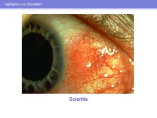 Ocular Manifestations of Systemic Disease | PDF