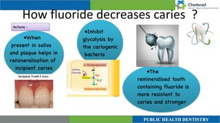 How fluoride decreases caries ?
Actions :
•Inhibit
glycolysis by
the cariogenic
bacteria
•When
present in saliva
and plaque helps in
remineralisation of
incipient caries
 

•The
remineralised tooth
containing fluoride is
more resistant to
caries and stronger
 