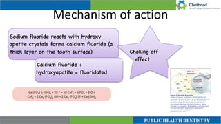 Mechanism of action
Sodium fluoride reacts with hydroxy
apetite crystals forms calcium fluoride (a
thick layer on the tooth surface)
Calcium fluoride +
hydroxyapatite = fluoridated
Choking off
effect
 