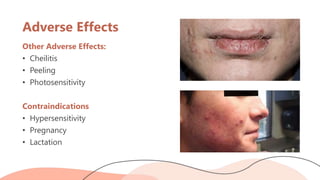 Retinoid Rash Systemic and Topical Retinoids in Dermatology | PPTX