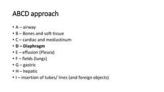 Systemic approach for reading Chest X-rays.pdf