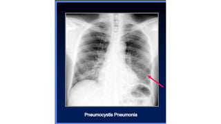 Systemic approach for reading Chest X-rays.pdf