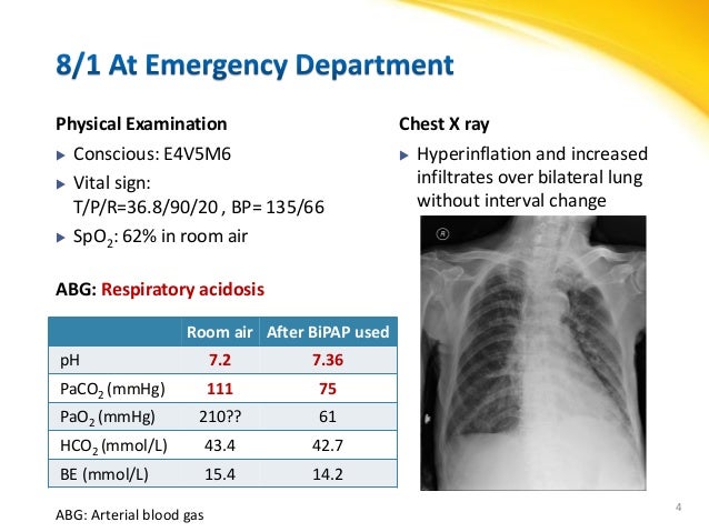 Systemic corticosteroids in the treatment of acute 