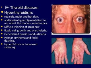 Hyperthyroid Skin Systemic diseases - Diabetes & Cutaneous.ppt