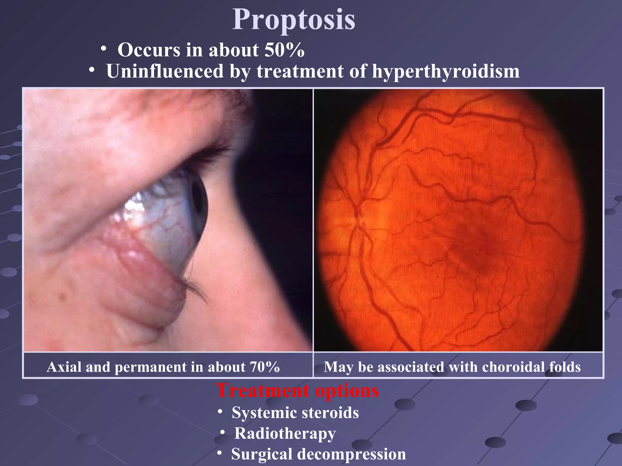 Systemic Diseases and the Eye | PPT