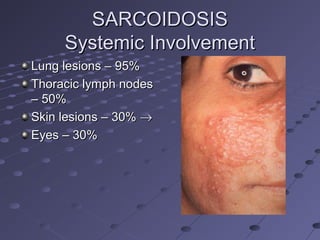Systemic Diseases and the Eye | PPT