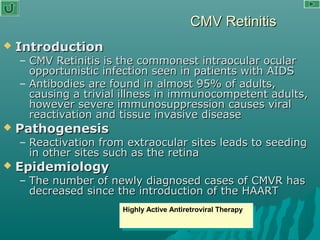 CMV RetinitisCMV Retinitis
 IntroductionIntroduction
– CMV Retinitis is the commonest intraocular ocularCMV Retinitis is the commonest intraocular ocular
opportunistic infection seen in patients with AIDSopportunistic infection seen in patients with AIDS
– Antibodies are found in almost 95% of adults,Antibodies are found in almost 95% of adults,
causing a trivial illness in immunocompetent adults,causing a trivial illness in immunocompetent adults,
however severe immunosuppression causes viralhowever severe immunosuppression causes viral
reactivation and tissue invasive diseasereactivation and tissue invasive disease
 PathogenesisPathogenesis
– Reactivation from extraocular sites leads to seedingReactivation from extraocular sites leads to seeding
in other sites such as the retinain other sites such as the retina
 EpidemiologyEpidemiology
– The number of newly diagnosed cases of CMVR hasThe number of newly diagnosed cases of CMVR has
decreased since the introduction of the HAARTdecreased since the introduction of the HAART
Highly Active Antiretroviral TherapyHighly Active Antiretroviral Therapy
 