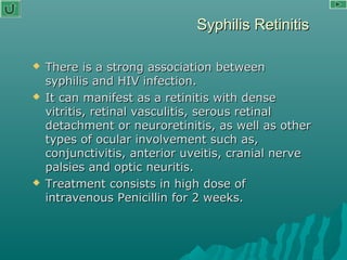 Syphilis RetinitisSyphilis Retinitis
 There is a strong association betweenThere is a strong association between
syphilis and HIV infection.syphilis and HIV infection.
 It can manifest as a retinitis with denseIt can manifest as a retinitis with dense
vitritis, retinal vasculitis, serous retinalvitritis, retinal vasculitis, serous retinal
detachment or neuroretinitis, as well as otherdetachment or neuroretinitis, as well as other
types of ocular involvement such as,types of ocular involvement such as,
conjunctivitis, anterior uveitis, cranial nerveconjunctivitis, anterior uveitis, cranial nerve
palsies and optic neuritis.palsies and optic neuritis.
 Treatment consists in high dose ofTreatment consists in high dose of
intravenous Penicillin for 2 weeks.intravenous Penicillin for 2 weeks.
 