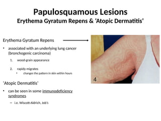 Dermatitis Repens Systemic Disease & Underlying Malignancy Clinical Pathology Study ...