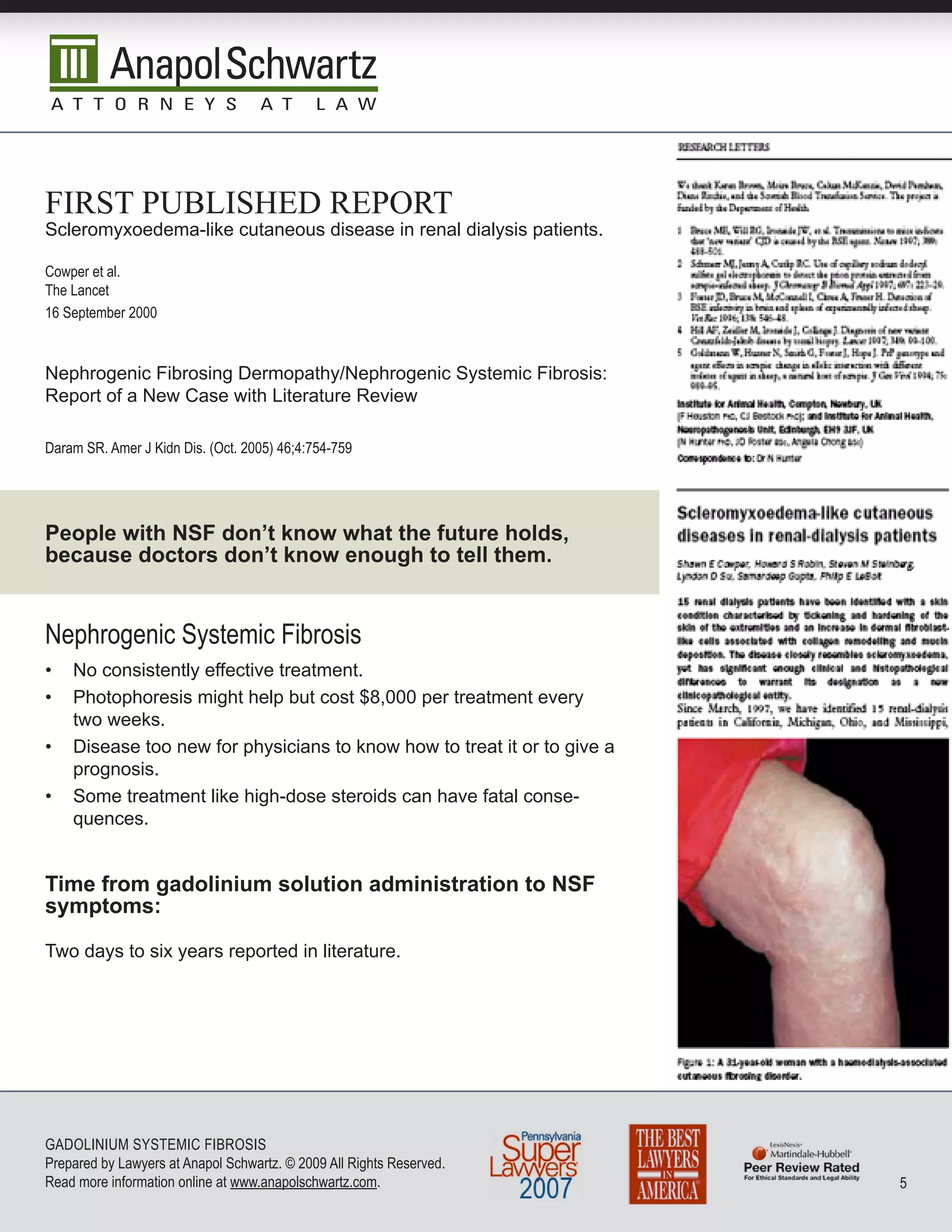 firsT pubLished repOrT
Scleromyxoedema-like cutaneous disease in renal dialysis patients.

Cowper et al.
The Lancet
16 September 2000


Nephrogenic Fibrosing Dermopathy/Nephrogenic Systemic Fibrosis:
Report of a New Case with Literature Review

Daram SR. Amer J Kidn Dis. (oct. 200) 6;:7-79




People with NSF don’t know what the future holds,
because doctors don’t know enough to tell them.


nephrogenic Systemic Fibrosis
•   No consistently effective treatment.
•   Photophoresis might help but cost $8,000 per treatment every
    two weeks.
•   Disease too new for physicians to know how to treat it or to give a
    prognosis.
•   Some treatment like high-dose steroids can have fatal conse-
    quences.


Time from gadolinium solution administration to NSF
symptoms:

Two days to six years reported in literature.




GADoLInIuM SySTEMIC FIbRoSIS
Prepared by Lawyers at Anapol Schwartz. © 2009 All Rights Reserved.
Read more information online at www.anapolschwartz.com.                   
 