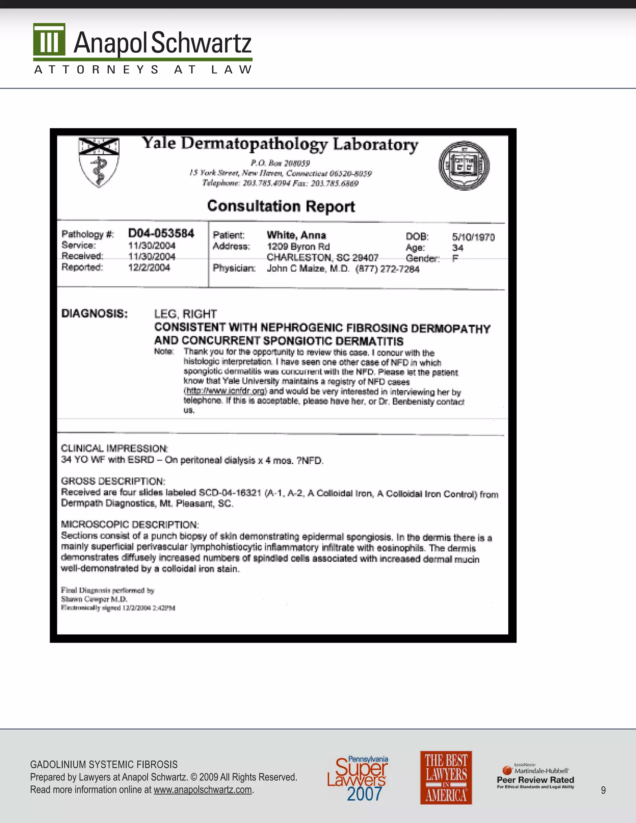 GADoLInIuM SySTEMIC FIbRoSIS
Prepared by Lawyers at Anapol Schwartz. © 2009 All Rights Reserved.
Read more information online at www.anapolschwartz.com.               9
 