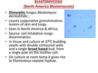 BLASTOMYCOSIS
(North America Blastomycosis)
• Dimorphic fungus Blastomyces
dermatitidis ;
• causes suppurative granulomatous
lesions of skin and lungs.
• Seen in North America & Africa;
• Source–soil-inhalation-lungs-
dissemination.
• In tissue and culture at 370C budding
yeasts with double contoured walls
and a single broad based bud, from
a single pole on the mother cell.
• On culture at room temp it gives rise
to filamentous septate hyphae.
 