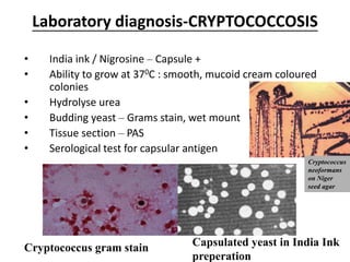 Laboratory diagnosis-CRYPTOCOCCOSIS
• India ink / Nigrosine – Capsule +
• Ability to grow at 370C : smooth, mucoid cream coloured
colonies
• Hydrolyse urea
• Budding yeast – Grams stain, wet mount
• Tissue section – PAS
• Serological test for capsular antigen
Cryptococcus gram stain Capsulated yeast in India Ink
preperation
Cryptococcus
neoformans
on Niger
seed agar
 