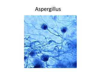 Aspergillus
 