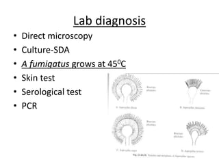Lab diagnosis
• Direct microscopy
• Culture-SDA
• A fumigatus grows at 450C
• Skin test
• Serological test
• PCR
 