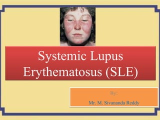 Systemic Lupus
Erythematosus (SLE)
By:
Mr. M. Sivananda Reddy
 