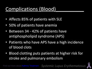Systemic Lupus Erythematosus | PPT