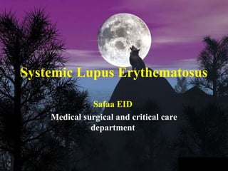 Systemic Lupus Erythematosus

               Safaa EID
    Medical surgical and critical care
              department
 