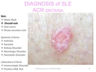 Scla Rash Systemic lupus erythematosus | PPTX