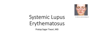 Systemic Lupus
Erythematosus
Pratap Sagar Tiwari, MD
Pic reference: autoimmunityblog.com
 