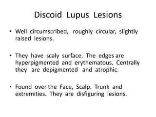 Discoid Lupus Lesions
• Well circumscribed, roughly circular, slightly
raised lesions.
• They have scaly surface. The edges are
hyperpigmented and erythematous. Centrally
they are depigmented and atrophic.
• Found over the Face, Scalp. Trunk and
extremities. They are disfiguring lesions.
 