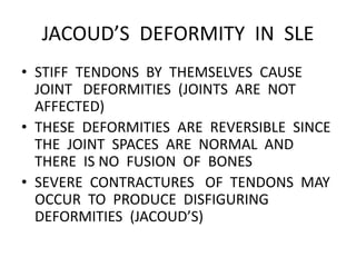 JACOUD’S DEFORMITY IN SLE
• STIFF TENDONS BY THEMSELVES CAUSE
JOINT DEFORMITIES (JOINTS ARE NOT
AFFECTED)
• THESE DEFORMITIES ARE REVERSIBLE SINCE
THE JOINT SPACES ARE NORMAL AND
THERE IS NO FUSION OF BONES
• SEVERE CONTRACTURES OF TENDONS MAY
OCCUR TO PRODUCE DISFIGURING
DEFORMITIES (JACOUD’S)
 