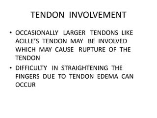 TENDON INVOLVEMENT
• OCCASIONALLY LARGER TENDONS LIKE
ACILLE’S TENDON MAY BE INVOLVED
WHICH MAY CAUSE RUPTURE OF THE
TENDON
• DIFFICULTY IN STRAIGHTENING THE
FINGERS DUE TO TENDON EDEMA CAN
OCCUR
 